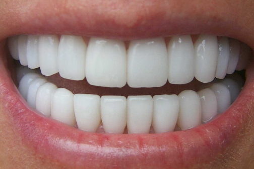 white teeth